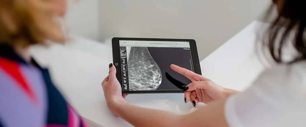 OPENRAD medical imaging breast digitalisation qyadeypljfjqtrqhpogylsoobyy