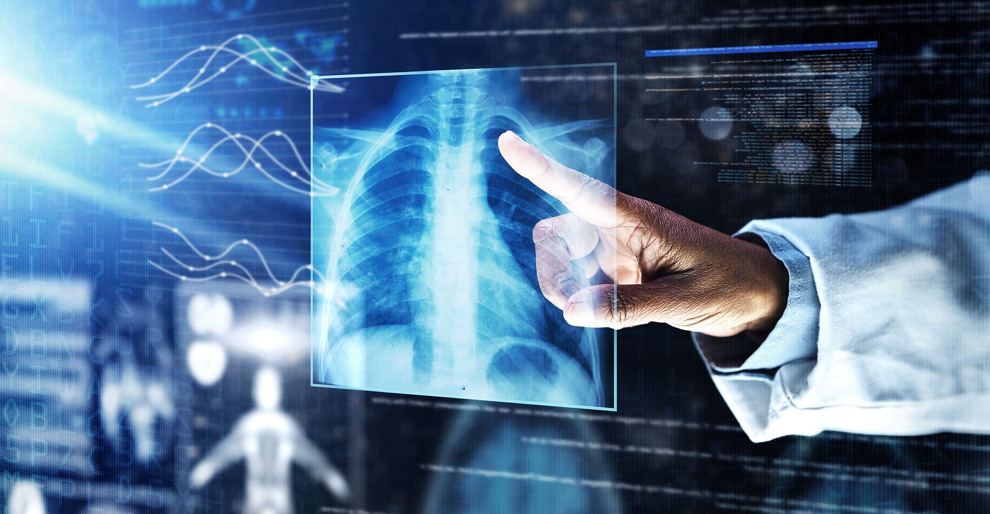 Radiology Trends OpenRad Cloud (by Biotronics3D) Medical lungs scan for surgery planning